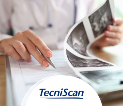 Tecniscan